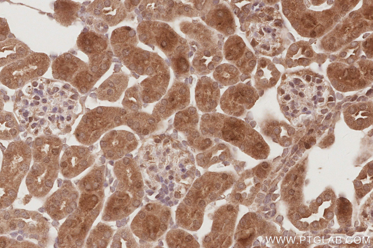 Immunohistochemical analysis of paraffin-embedded mouse kidney tissue slide using KHC2895 (STRADB IHC Kit).
