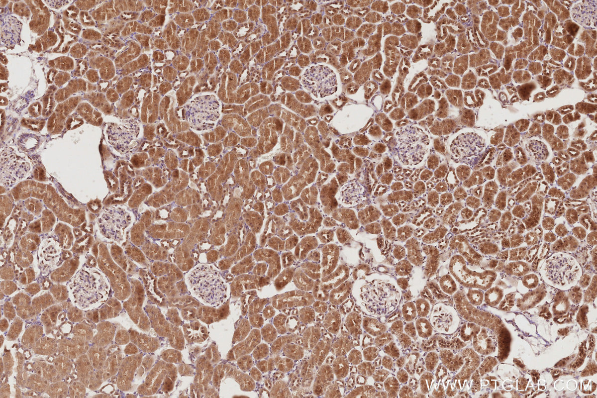 Immunohistochemical analysis of paraffin-embedded rat kidney tissue slide using KHC2895 (STRADB IHC Kit).