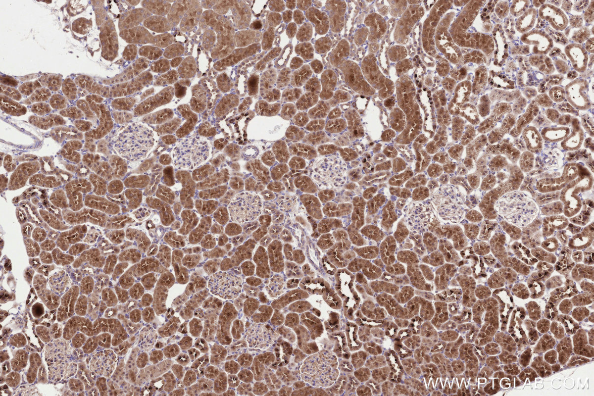 Immunohistochemical analysis of paraffin-embedded rat kidney tissue slide using KHC3302 (STT3B IHC Kit).
