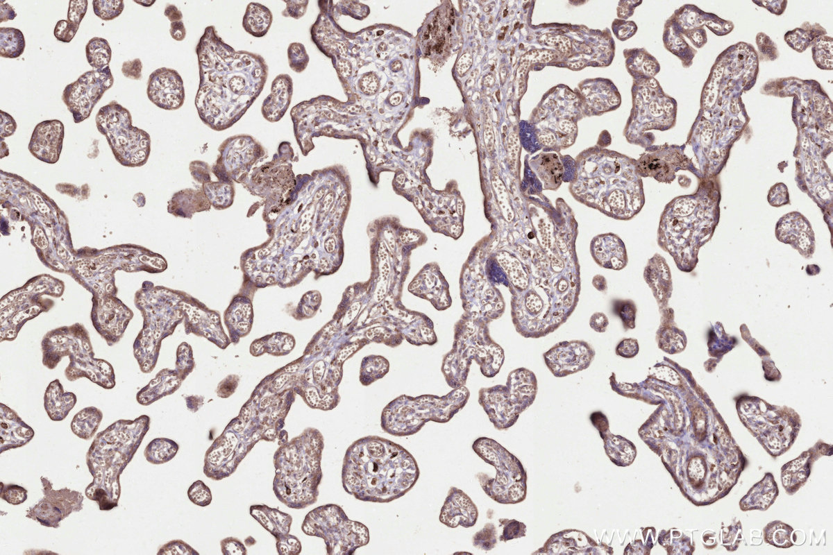 Immunohistochemical analysis of paraffin-embedded human placenta tissue slide using KHC3302 (STT3B IHC Kit).