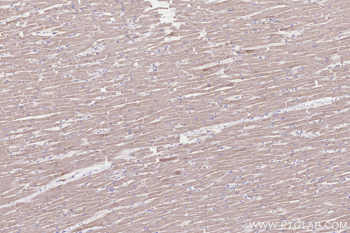 Immunohistochemical analysis of paraffin-embedded human heart tissue slide using KHC3302 (STT3B IHC Kit).