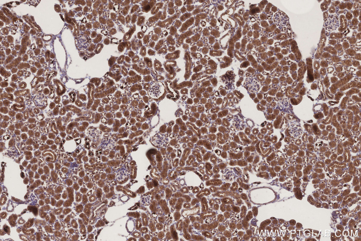 Immunohistochemical analysis of paraffin-embedded mouse kidney tissue slide using KHC3302 (STT3B IHC Kit).