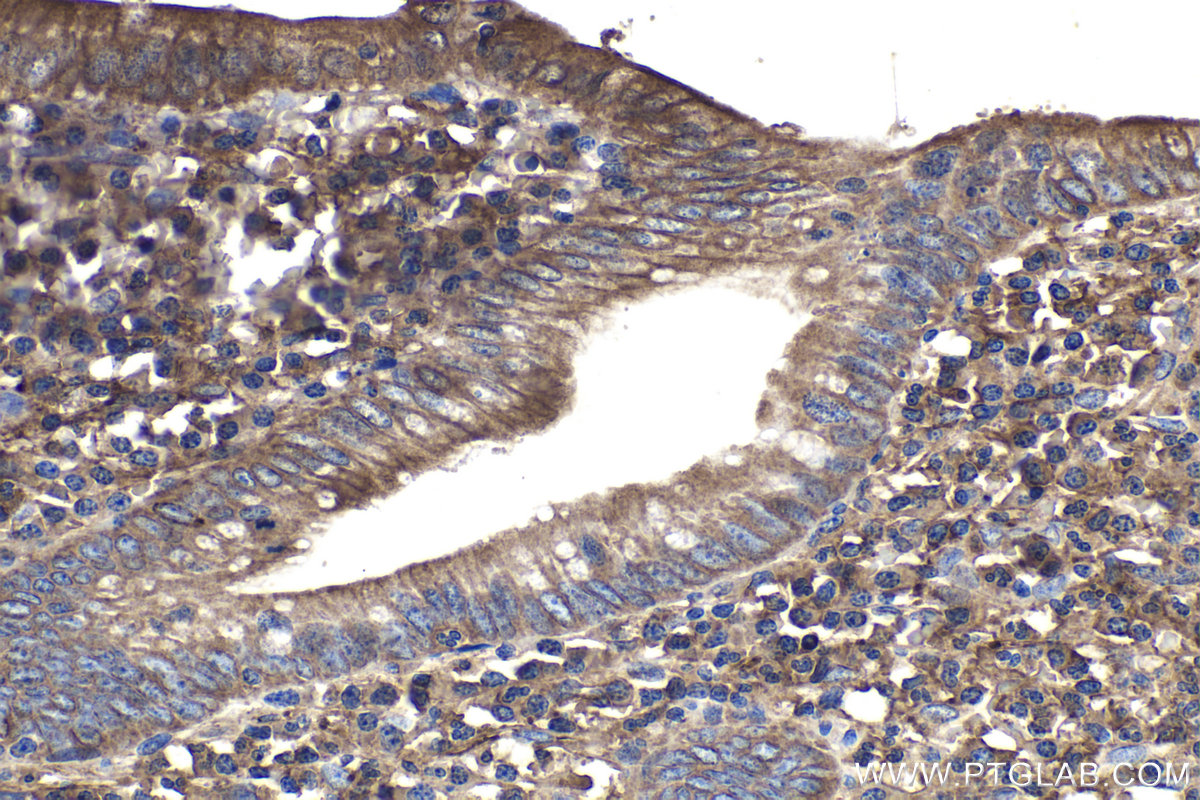 Immunohistochemical analysis of paraffin-embedded human appendicitis tissue slide using KHC1153 (STX11 IHC Kit).