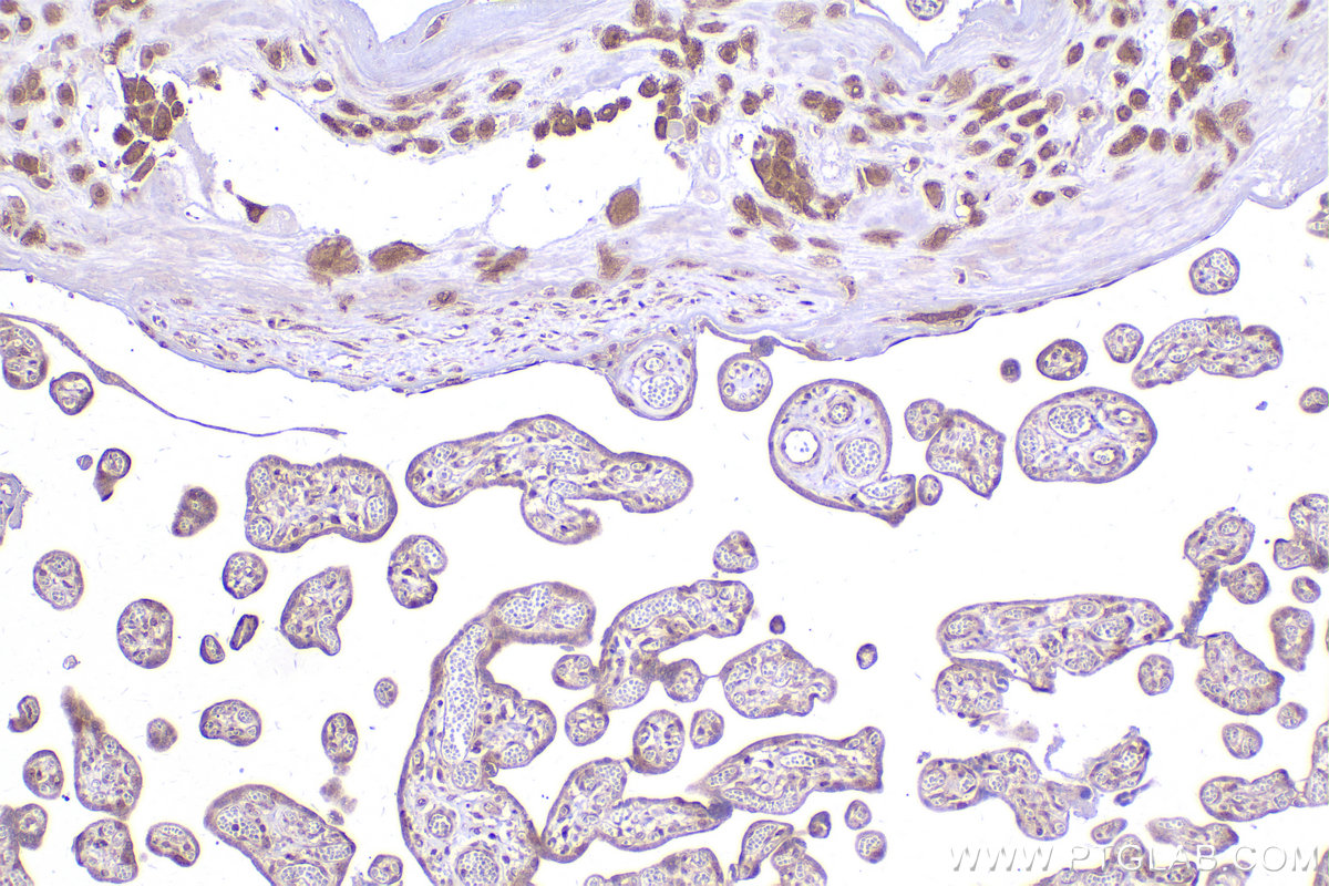 Immunohistochemical analysis of paraffin-embedded human placenta tissue slide using KHC2422 (STX5 IHC Kit).