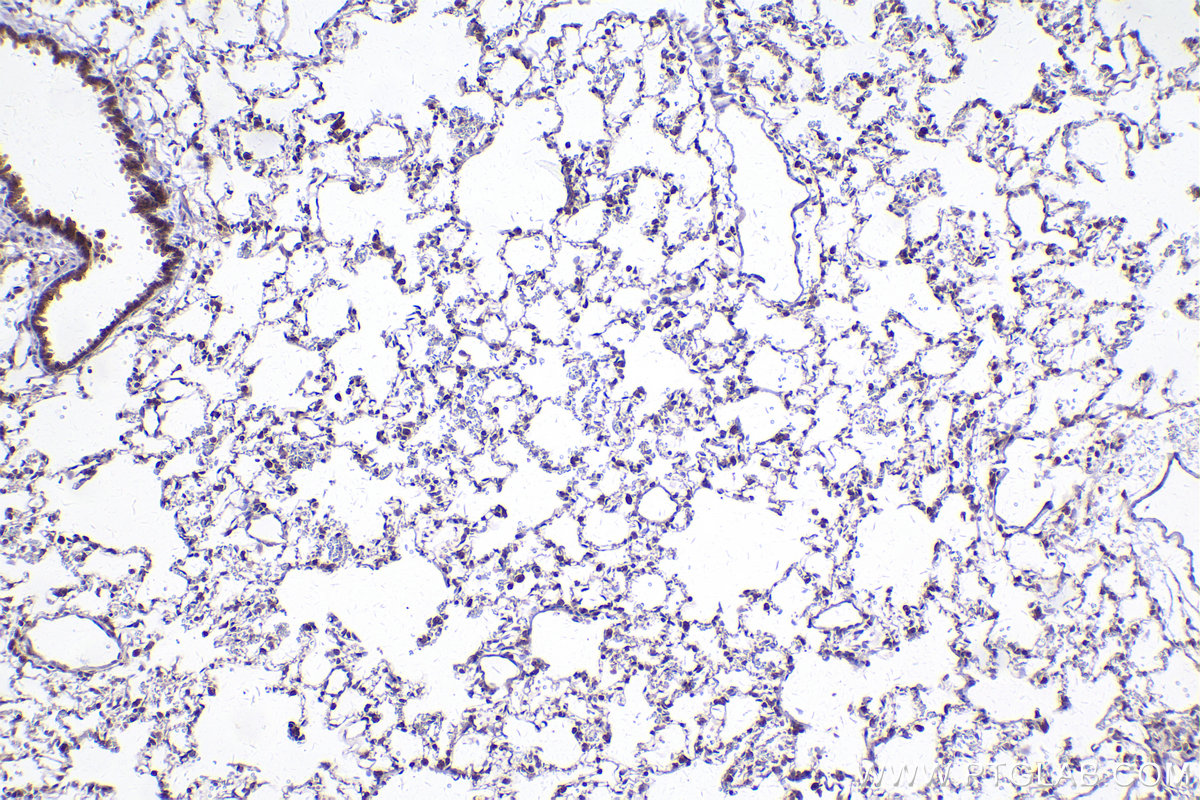 Immunohistochemical analysis of paraffin-embedded rat lung tissue slide using KHC2422 (STX5 IHC Kit).