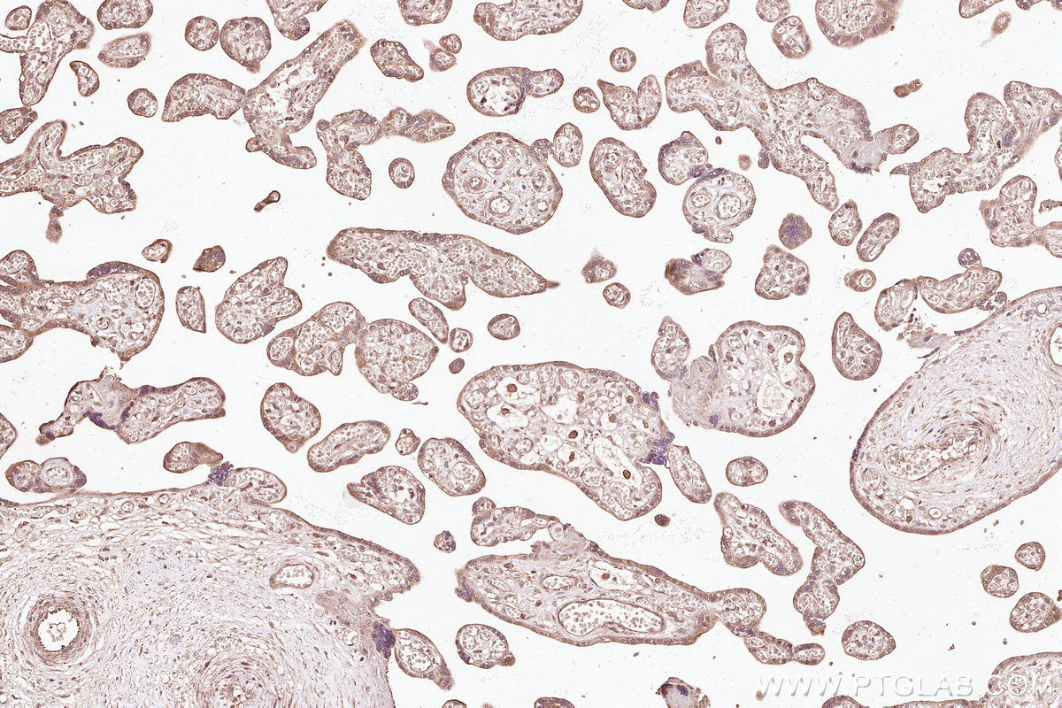 Immunohistochemical analysis of paraffin-embedded human placenta tissue slide using KHC3092 (STYXL1 IHC Kit).