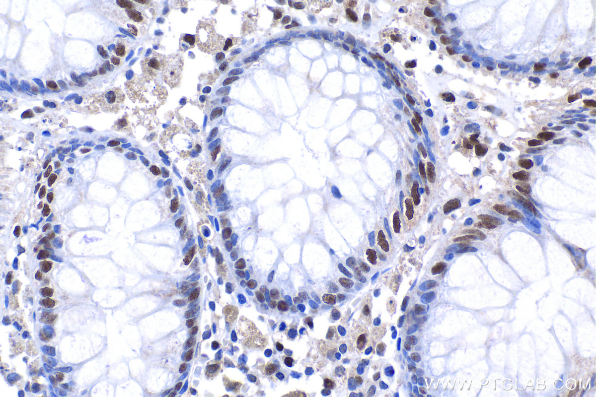 Immunohistochemical analysis of paraffin-embedded human colon tissue slide using KHC1197 (SUB1 IHC Kit).