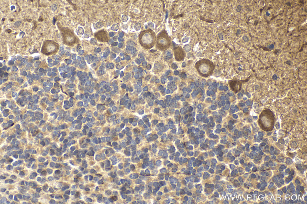 Immunohistochemical analysis of paraffin-embedded rat cerebellum tissue slide using KHC2001 (SUFU IHC Kit).