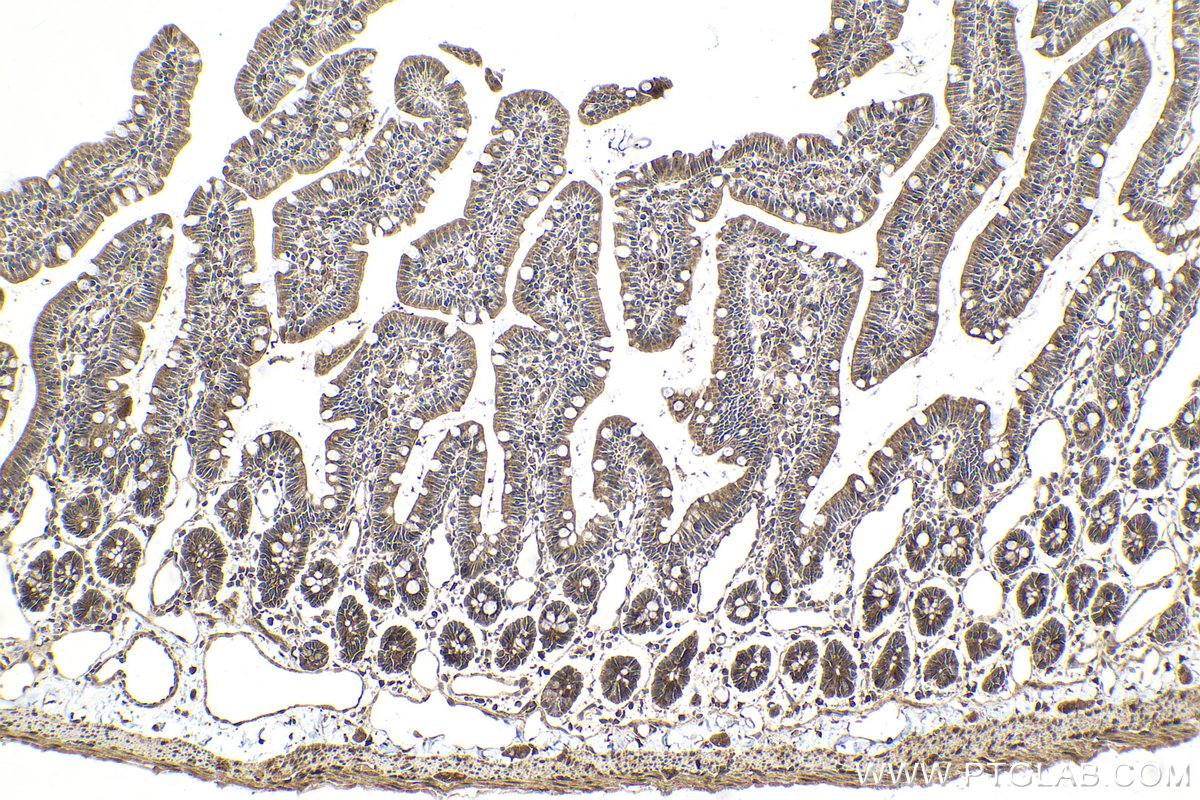 Immunohistochemical analysis of paraffin-embedded rat small intestine tissue slide using KHC2001 (SUFU IHC Kit).