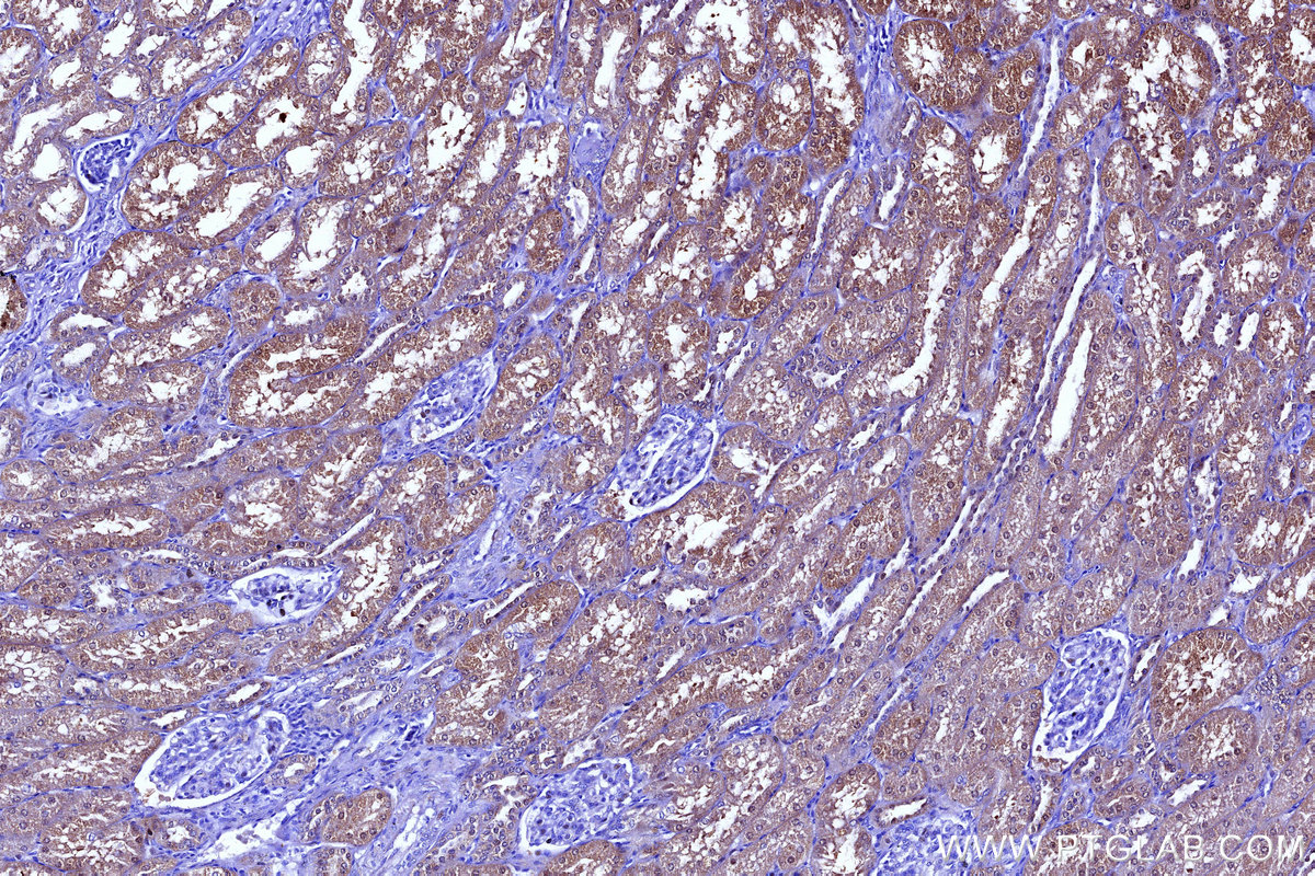 Immunohistochemical analysis of paraffin-embedded human kidney tissue slide using KHC3135 (SULT1C2 IHC Kit).