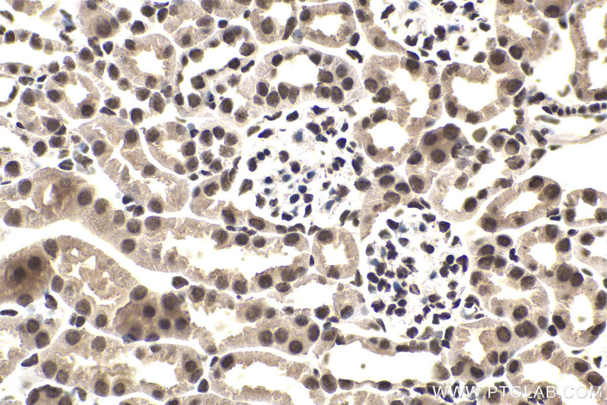 Immunohistochemical analysis of paraffin-embedded mouse kidney tissue slide using KHC1649 (SUMO1 IHC Kit).