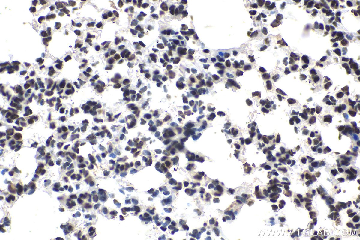 Immunohistochemical analysis of paraffin-embedded mouse lung tissue slide using KHC1649 (SUMO1 IHC Kit).