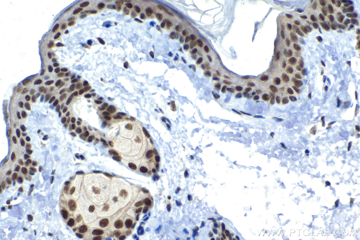 Immunohistochemical analysis of paraffin-embedded rat skin tissue slide using KHC1485 (SUPT7L IHC Kit).