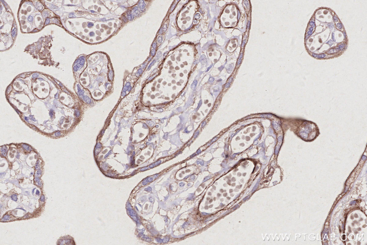 Immunohistochemical analysis of paraffin-embedded human placenta tissue slide using KHC3005 (SUSD2 IHC Kit). Immunohistochemical analysis of paraffin-embedded human placenta tissue slide using KHC3005 (SUSD2 IHC Kit).