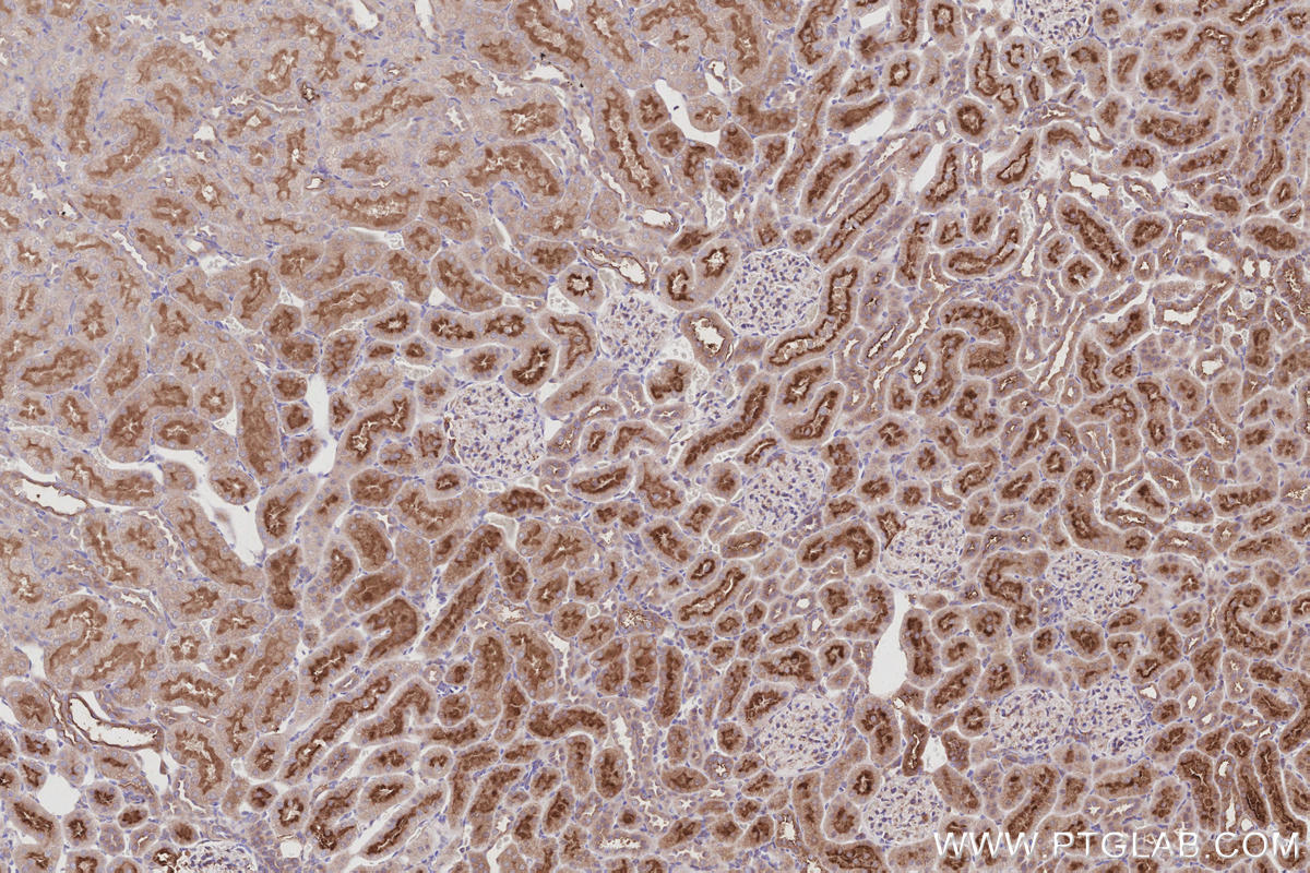 Immunohistochemical analysis of paraffin-embedded rat kidney tissue slide using KHC3005 (SUSD2 IHC Kit). Immunohistochemical analysis of paraffin-embedded rat kidney tissue slide using KHC3005 (SUSD2 IHC Kit).