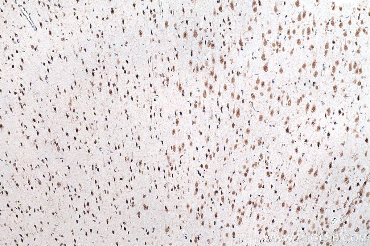 Immunohistochemical analysis of paraffin-embedded rat brain tissue slide using KHC0883 (SYNCRIP IHC Kit).