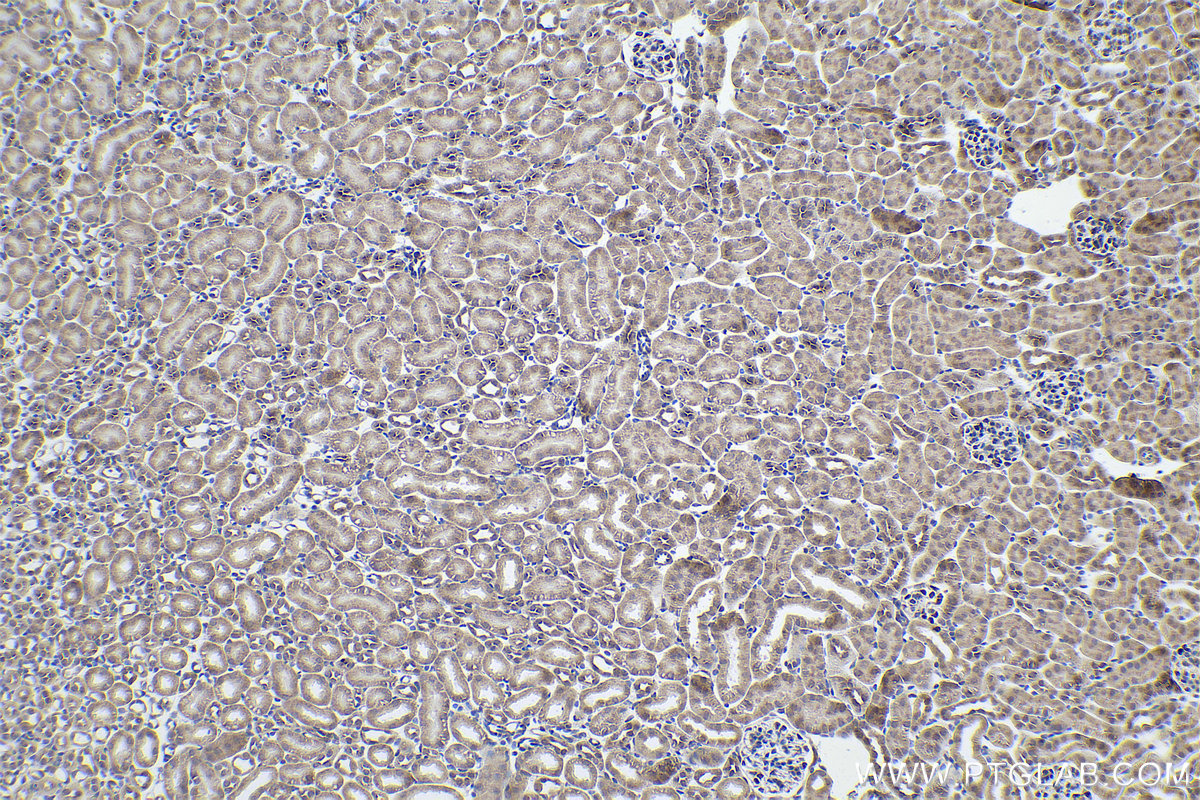 Immunohistochemical analysis of paraffin-embedded mouse kidney tissue slide using KHC0883 (SYNCRIP IHC Kit).