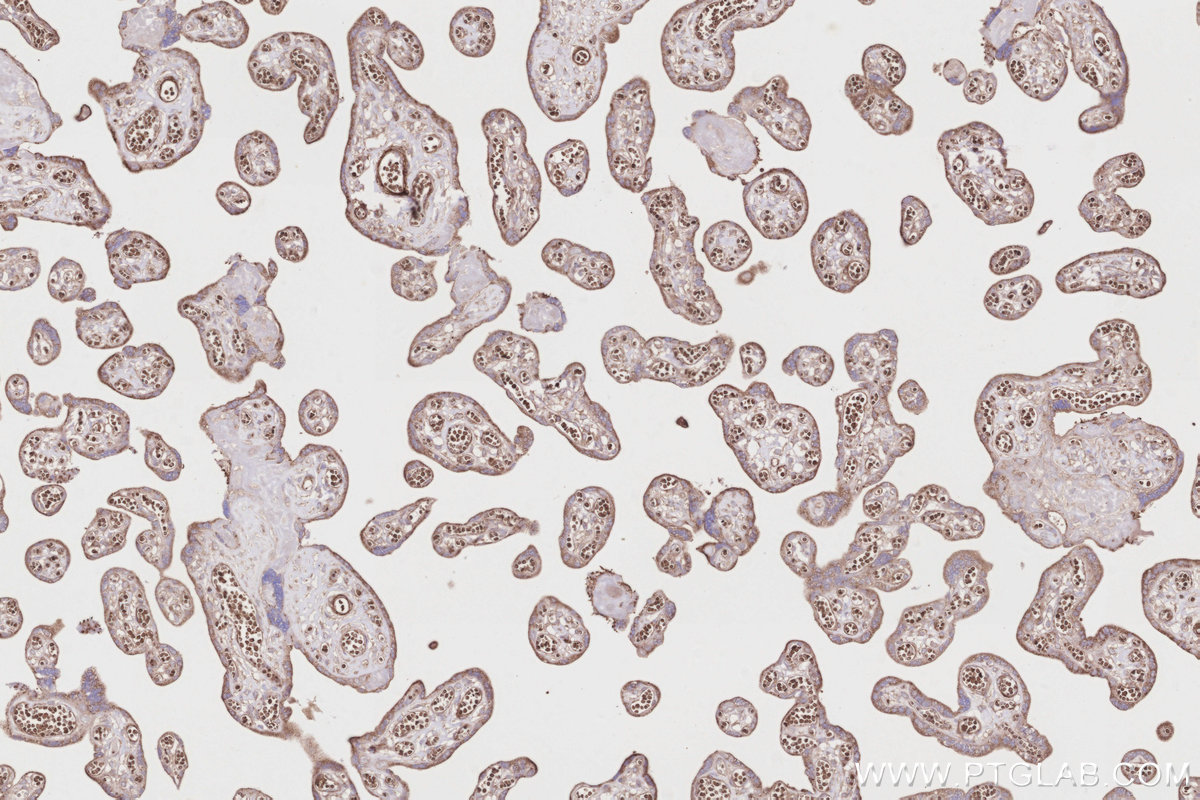 Immunohistochemical analysis of paraffin-embedded human placenta tissue slide using KHC2846 (Septin 5 IHC Kit).
