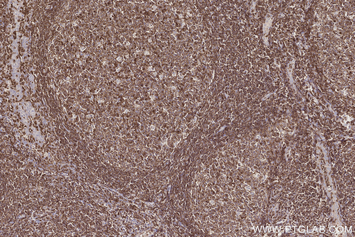Immunohistochemical analysis of paraffin-embedded human tonsillitis tissue slide using KHC2743 (Septin1/SEPT1 IHC Kit).