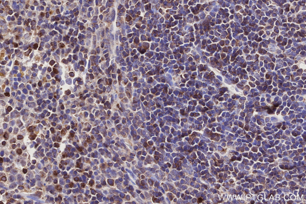 Immunohistochemical analysis of paraffin-embedded mouse spleen tissue slide using KHC2743 (Septin1/SEPT1 IHC Kit).
