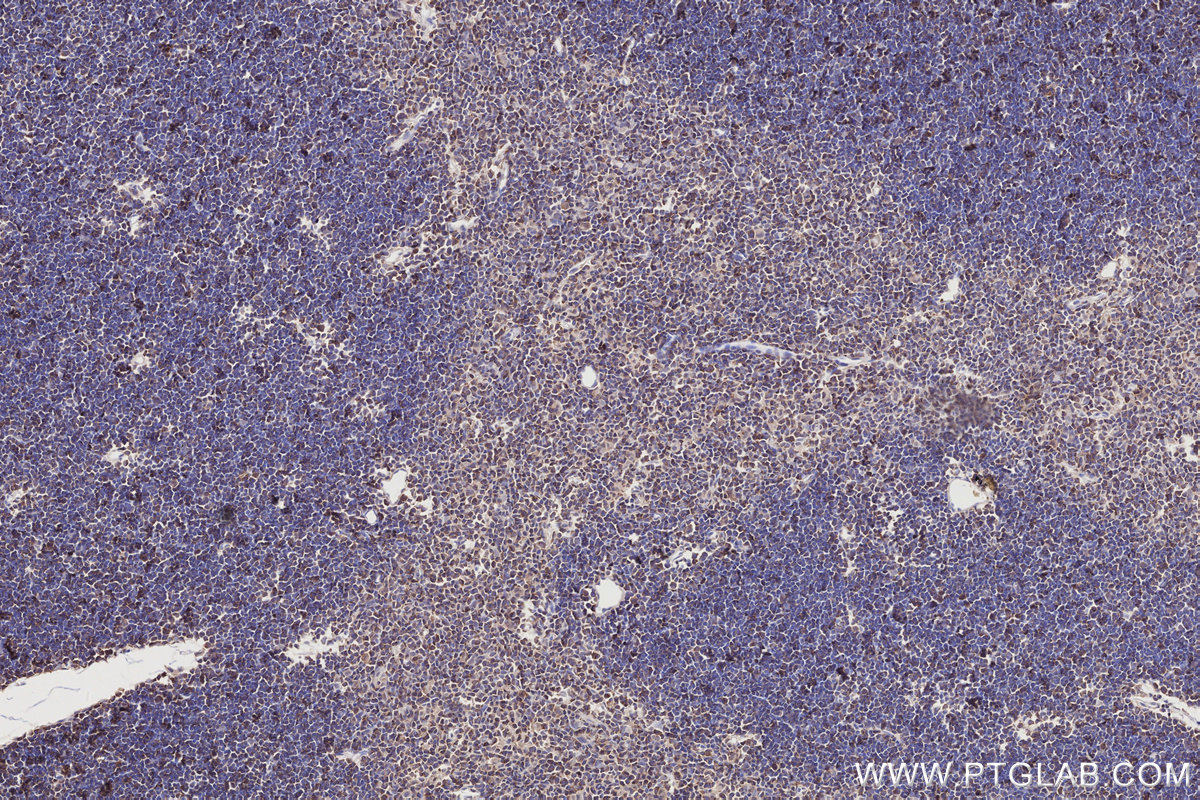 Immunohistochemical analysis of paraffin-embedded rat thymus tissue slide using KHC2743 (Septin1/SEPT1 IHC Kit).