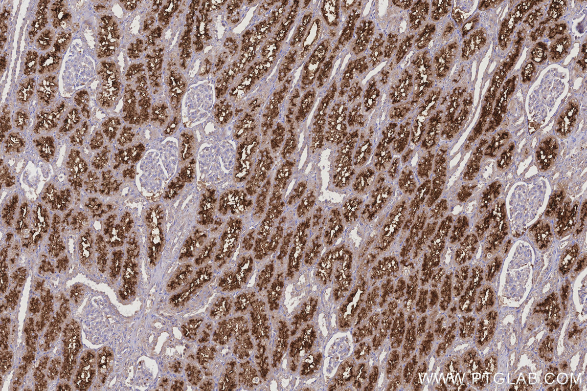 Immunohistochemical analysis of paraffin-embedded human kidney tissue slide using KHC3171 (Serpin A5 IHC Kit).