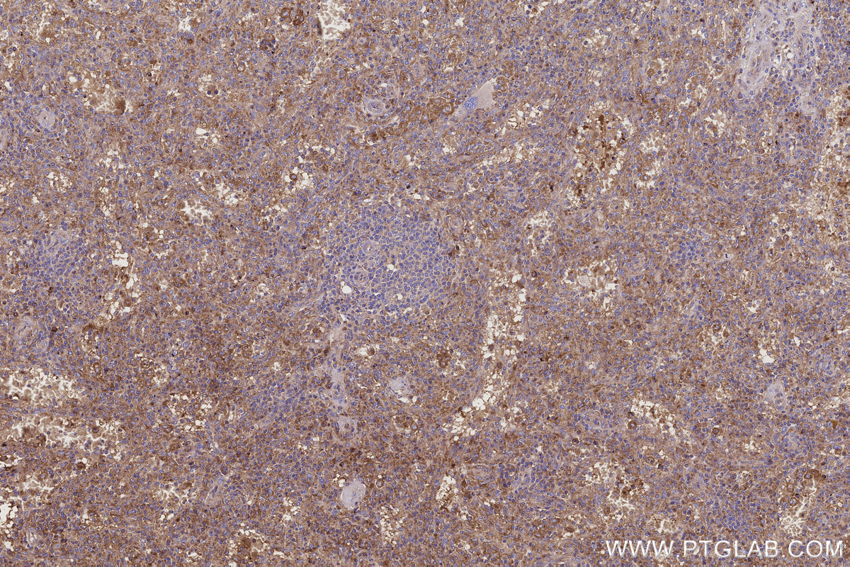 Immunohistochemical analysis of paraffin-embedded human spleen tissue slide using KHC3171 (Serpin A5 IHC Kit).