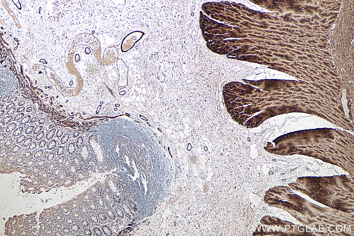 Immunohistochemical analysis of paraffin-embedded human colon tissue slide using KHC0597 (Smoothelin/SMTN IHC Kit).