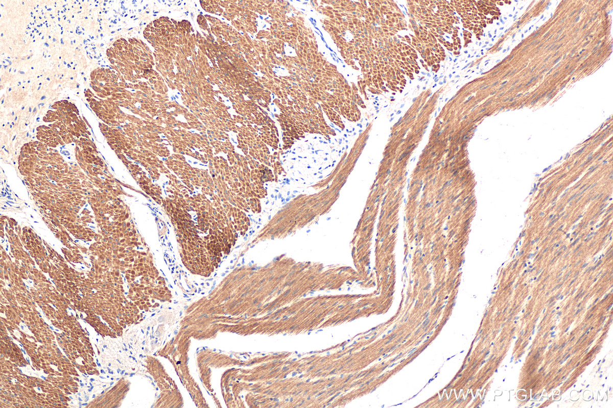 Immunohistochemical analysis of paraffin-embedded human small intestine tissue slide using KHC0597 (Smoothelin/SMTN IHC Kit).