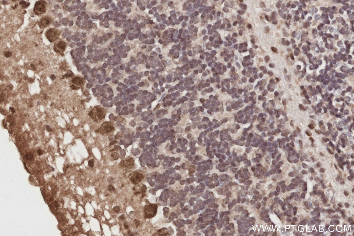 Immunohistochemical analysis of paraffin-embedded mouse cerebellum tissue slide using KHC2897 (Spartan IHC Kit). Immunohistochemical analysis of paraffin-embedded mouse cerebellum tissue slide using KHC2897 (Spartan IHC Kit).