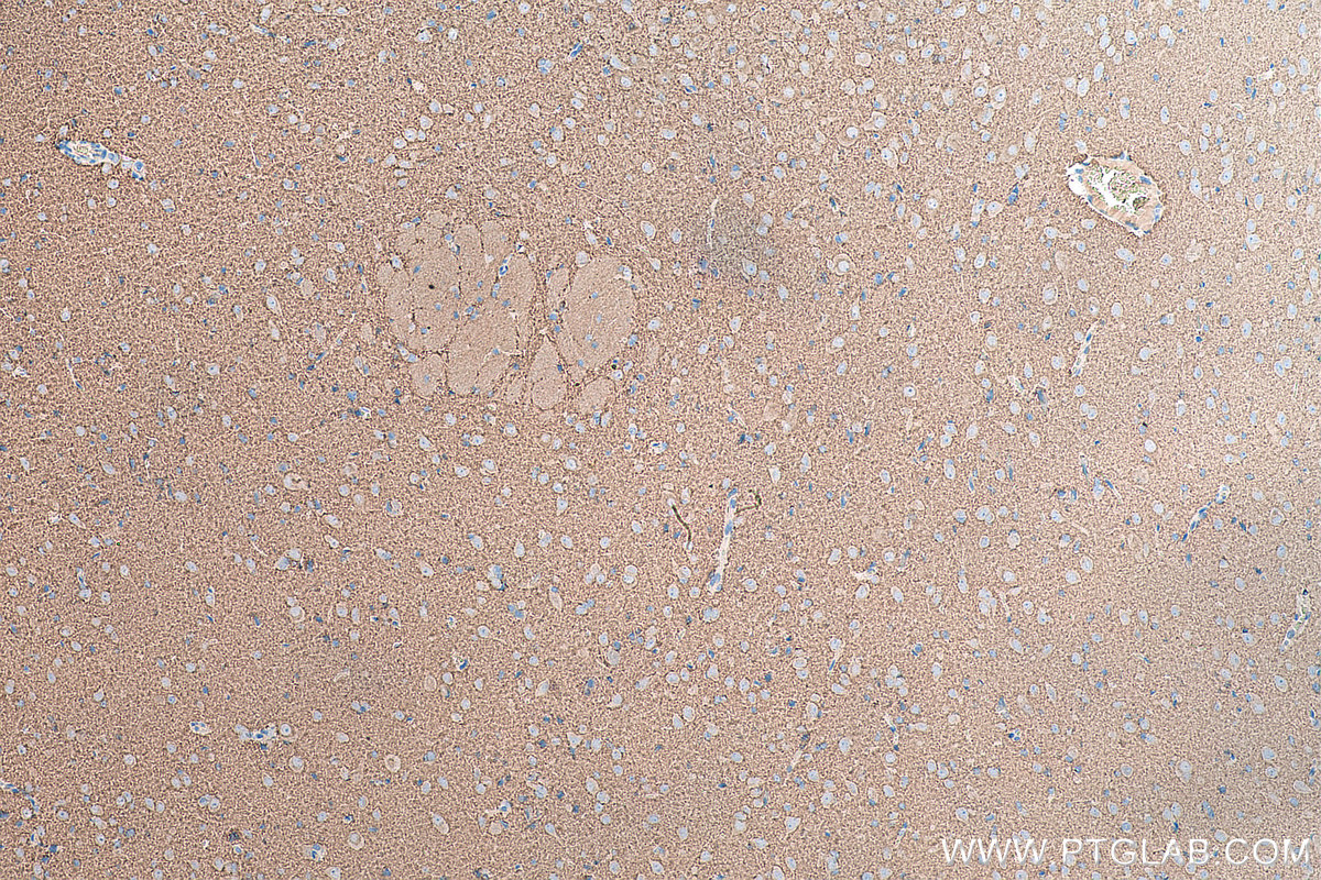 Immunohistochemical analysis of paraffin-embedded rat brain tissue slide using KHC0059 (Synaptophysin IHC Kit).