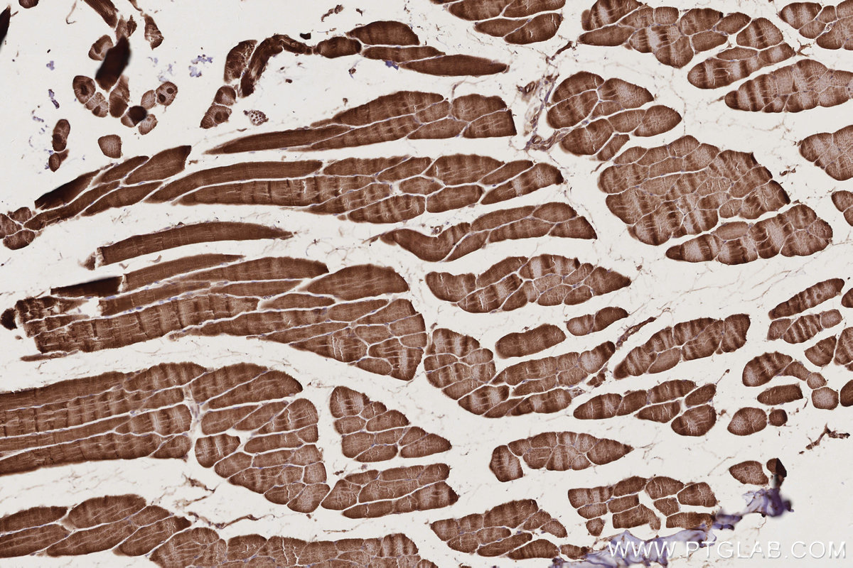 Immunohistochemical analysis of paraffin-embedded mouse skeletal muscle tissue slide using KHC2801 (Syndetin/CCDC132 IHC Kit).