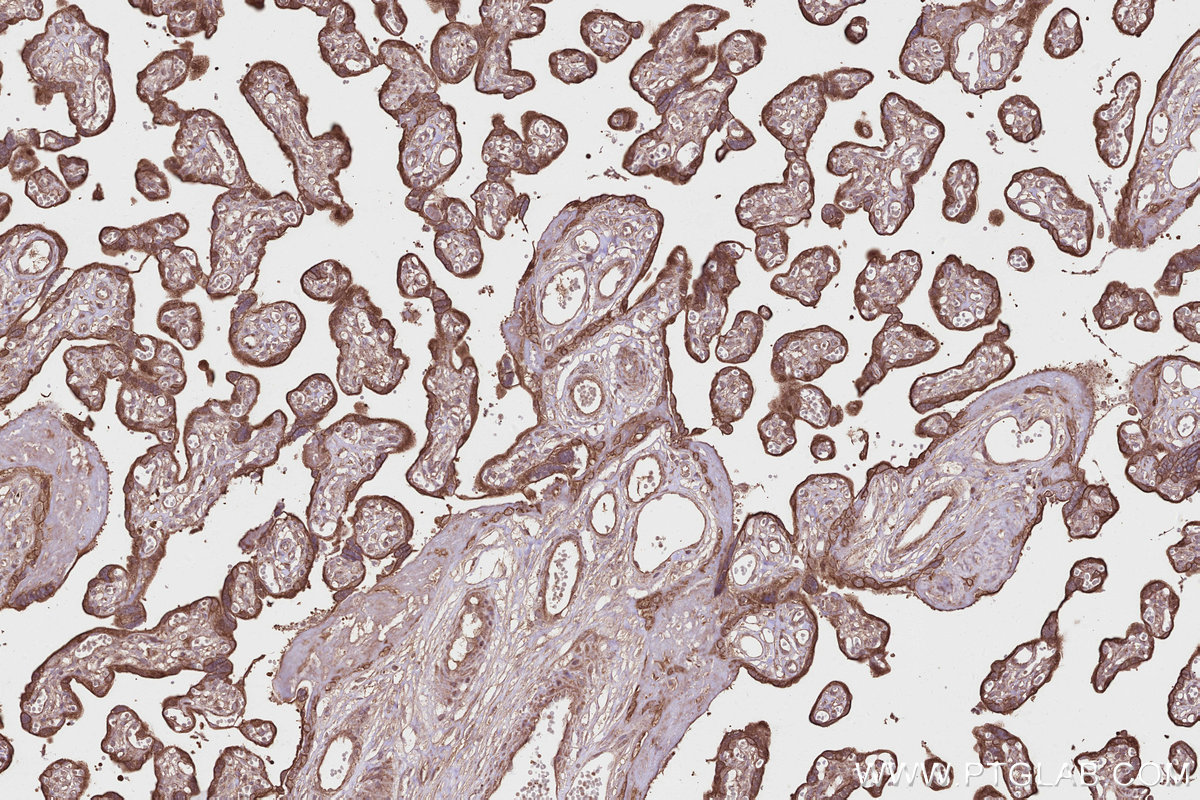 Immunohistochemical analysis of paraffin-embedded human placenta tissue slide using KHC2801 (Syndetin/CCDC132 IHC Kit).