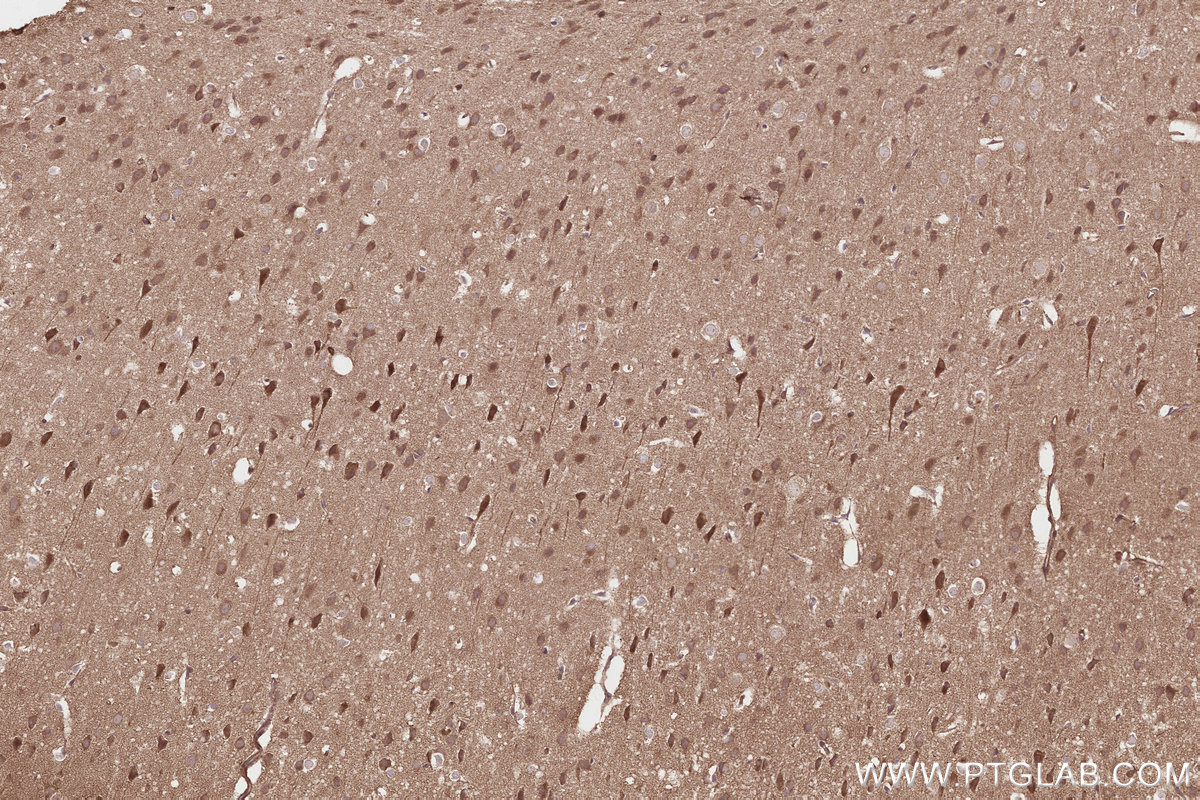 Immunohistochemical analysis of paraffin-embedded mouse brain tissue slide using KHC2801 (Syndetin/CCDC132 IHC Kit).