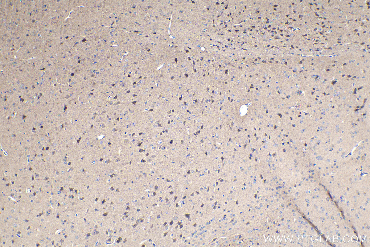 Immunohistochemical analysis of paraffin-embedded mouse brain tissue slide using KHC1101 (TAC1 IHC Kit).