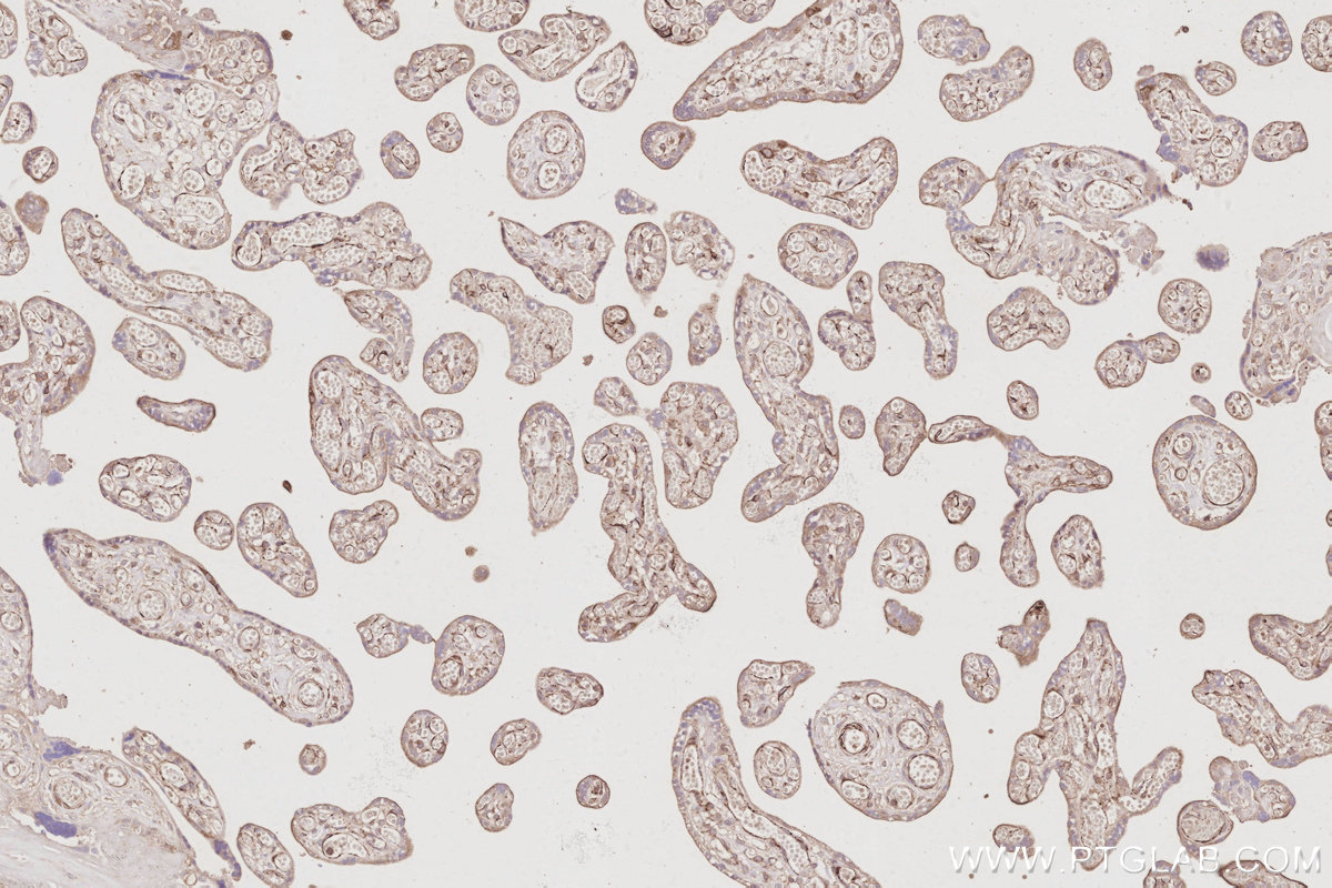 Immunohistochemical analysis of paraffin-embedded human placenta tissue slide using KHC3086 (TACC3 IHC Kit). Immunohistochemical analysis of paraffin-embedded human placenta tissue slide using KHC3086 (TACC3 IHC Kit).