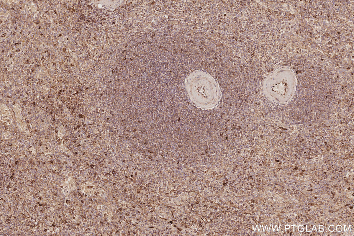 Immunohistochemical analysis of paraffin-embedded human spleen tissue slide using KHC3086 (TACC3 IHC Kit). Immunohistochemical analysis of paraffin-embedded human spleen tissue slide using KHC3086 (TACC3 IHC Kit).
