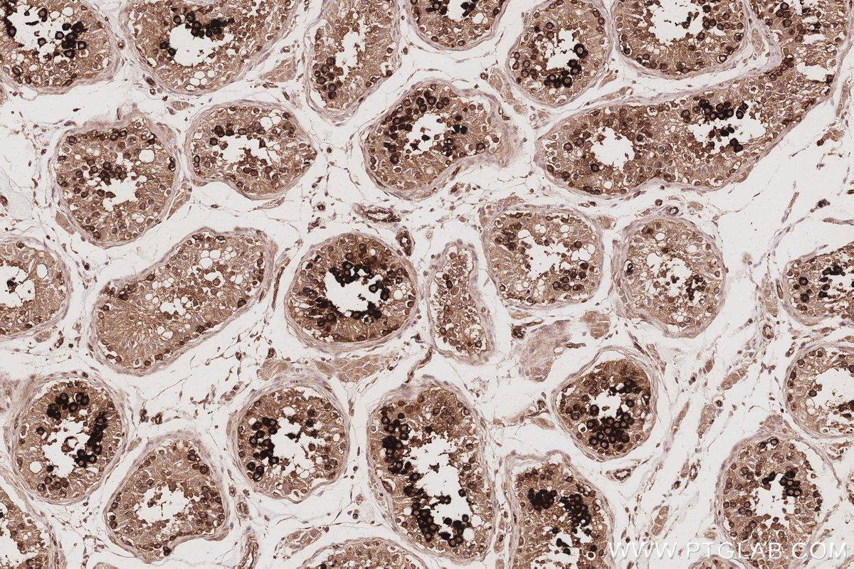 Immunohistochemical analysis of paraffin-embedded human testis tissue slide using KHC3086 (TACC3 IHC Kit). Immunohistochemical analysis of paraffin-embedded human testis tissue slide using KHC3086 (TACC3 IHC Kit).