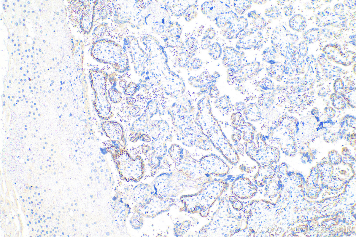 Immunohistochemical analysis of paraffin-embedded human placenta tissue slide using KHC0821 (TACSTD2 IHC Kit).