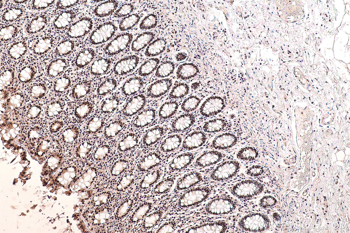 Immunohistochemical analysis of paraffin-embedded human colon tissue slide using KHC0714 (TALDO1 IHC Kit).