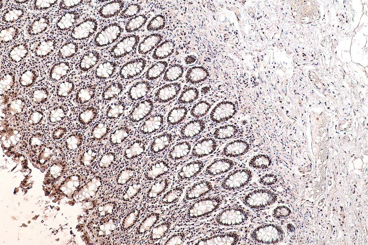 Immunohistochemical analysis of paraffin-embedded human colon tissue slide using KHC0714 (TALDO1 IHC Kit).