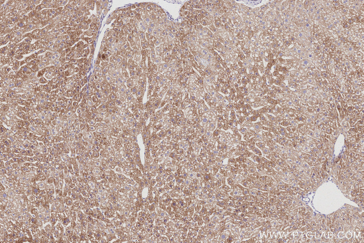 Immunohistochemical analysis of paraffin-embedded mouse liver tissue slide using KHC3031 (TAOK2 IHC Kit).