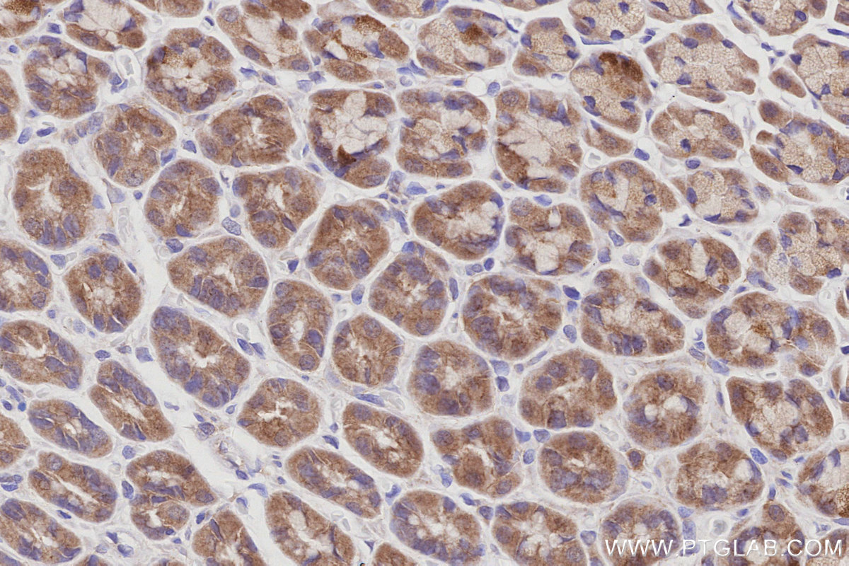 Immunohistochemical analysis of paraffin-embedded rat stomach tissue slide using KHC3031 (TAOK2 IHC Kit).