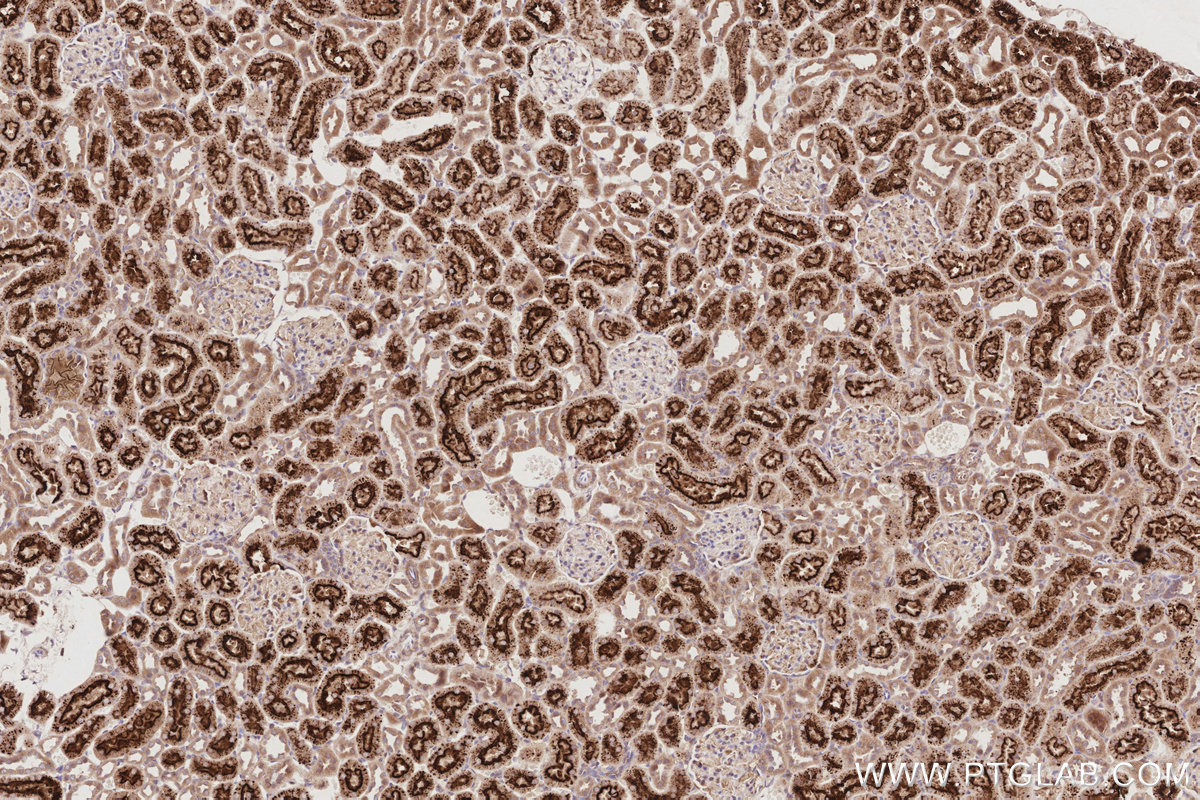 Immunohistochemical analysis of paraffin-embedded rat kidney tissue slide using KHC2908 (TAOK3 IHC Kit).