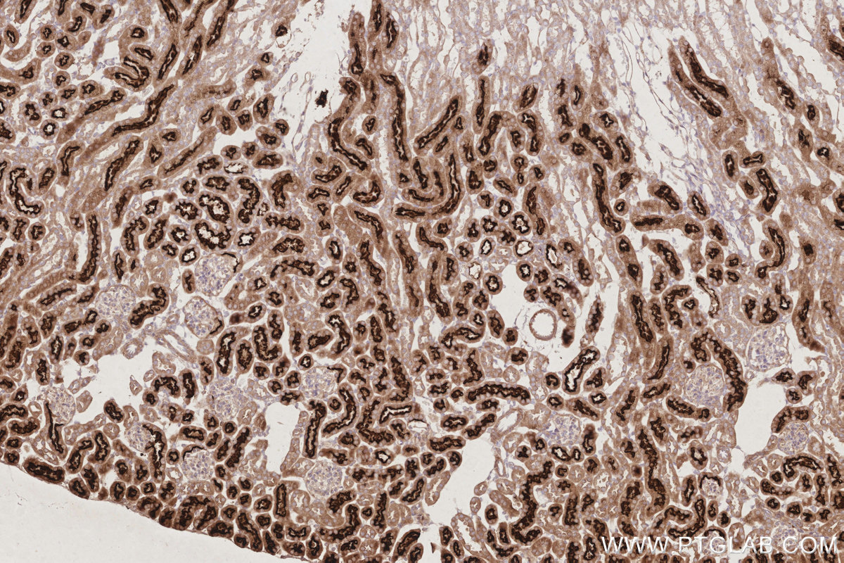 Immunohistochemical analysis of paraffin-embedded mouse kidney tissue slide using KHC2908 (TAOK3 IHC Kit).