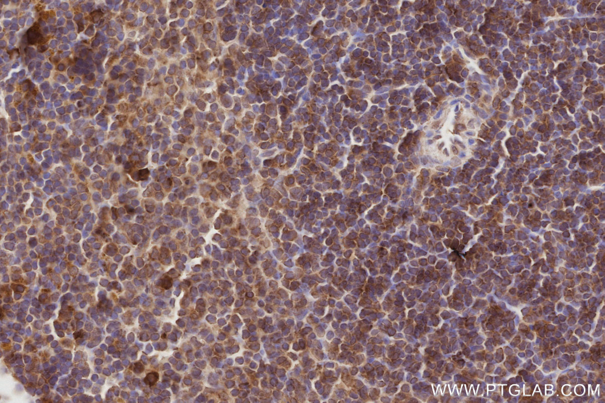 Immunohistochemical analysis of paraffin-embedded mouse spleen tissue slide using KHC2908 (TAOK3 IHC Kit).