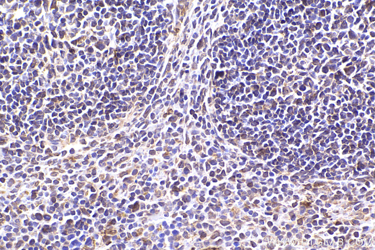 Immunohistochemical analysis of paraffin-embedded mouse spleen tissue slide using KHC2390 (TAP1 IHC Kit).
