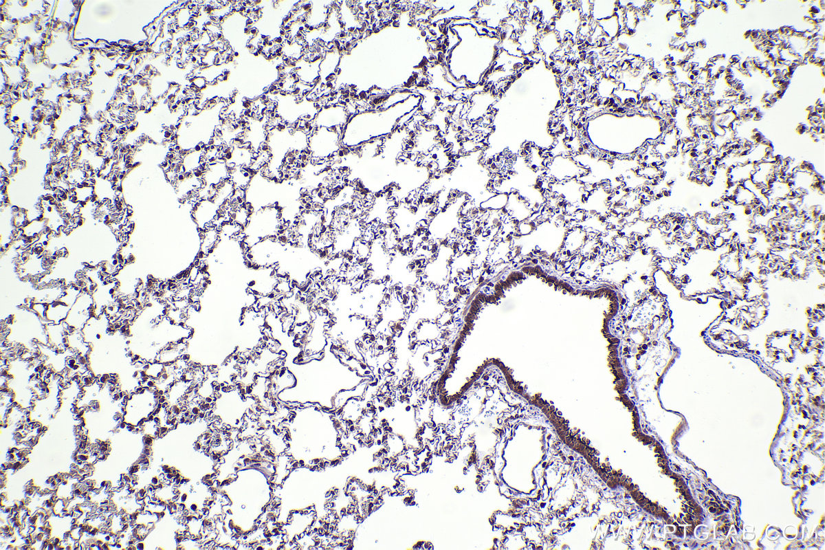 Immunohistochemical analysis of paraffin-embedded rat lung tissue slide using KHC2390 (TAP1 IHC Kit).