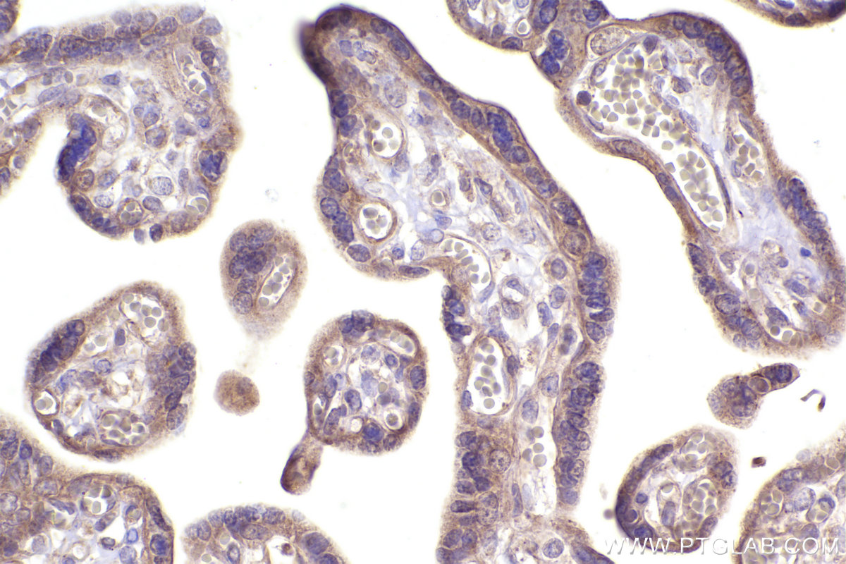 Immunohistochemical analysis of paraffin-embedded human placenta tissue slide using KHC2391 (TAP2 IHC Kit).
