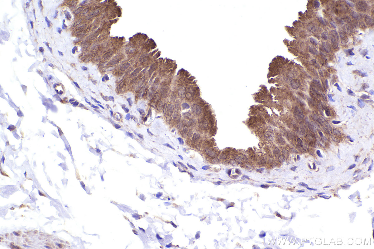 Immunohistochemical analysis of paraffin-embedded rat bladder tissue slide using KHC2391 (TAP2 IHC Kit).